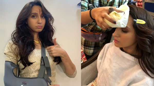 नोरा के सिर पर लगे चोट को फिल्म में ऐसे किया गया इस्तेमाल नोरा के सिर पर लगे चोट को फिल्म में ऐसे किया गया इस्तेमाल