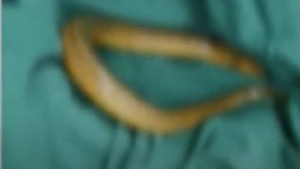 प्राइवेट पार्ट में डाली जहरीली मछली