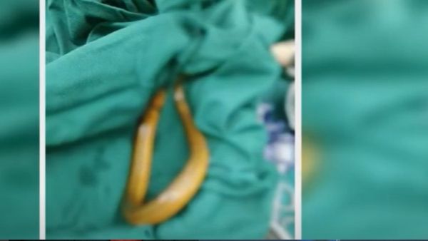 स्थिति हो गई थी गंभीर