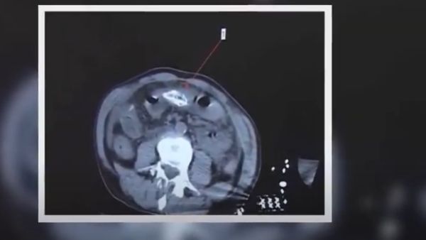 पहले भी हो चुका है ऐसा