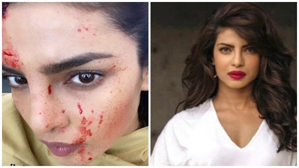 प्रियंका चोपड़ा के चेहरे पर खून के छींटे देख फैंस हैरान