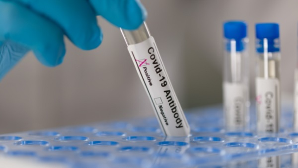 कोरोना के तीसरी लहर से बचने के लिए इन बातों का रखें ध्यान 