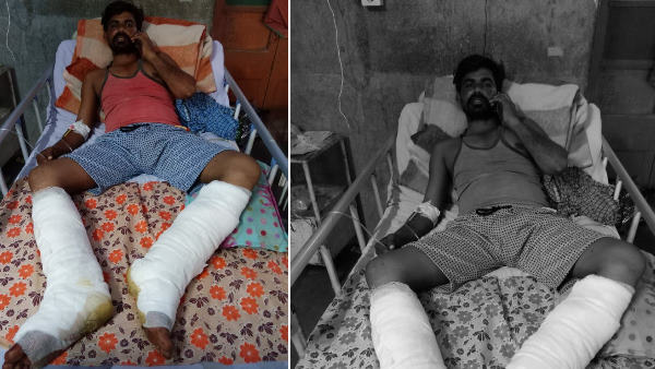 बीकानेर के पीबीएम अस्पताल में उपचार चल रहा बीकानेर के पीबीएम अस्पताल में उपचार चल रहा