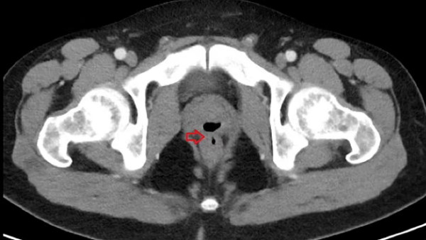 इस वजह से हुई ये दिक्कत इस वजह से हुई ये दिक्कत