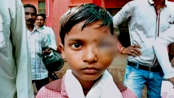 Fatehabad: 40 students beaten with sticks in school, 10 hospitalized, complaint filed Fatehabad: 40 students beaten with sticks in school, 10 hospitalized, complaint filed