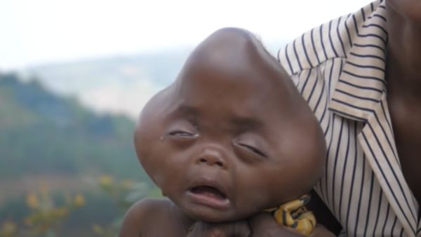 बच्चे को देखकर रोती है मां