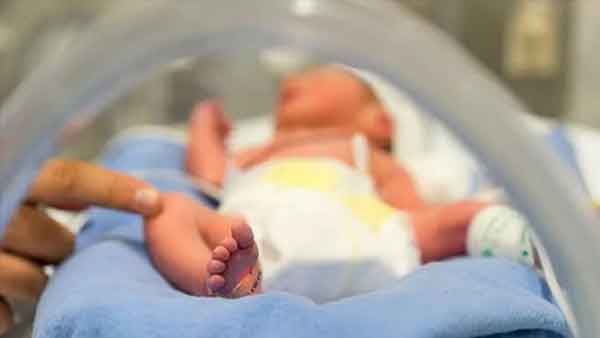 बिना आंख, नाक के पैदा हुई बच्ची