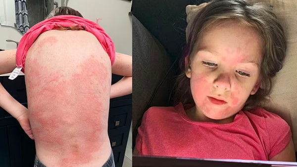 डॉक्टरों के टेस्ट के बाद हुआ खुलासा डॉक्टरों के टेस्ट के बाद हुआ खुलासा