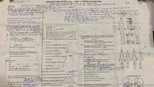 पोस्टमार्टम रिपोर्ट ने उठाए कई सवाल