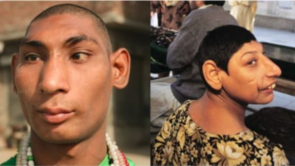 पाकिस्तान में लगातार बढ़ रहे रैट चिल्ड्रन