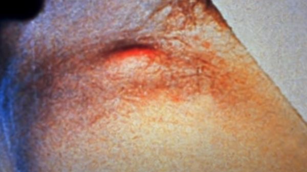 फेफड़ों को कर देता है खत्म