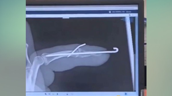 सोशल मीडिया पर यूजर खुजलाने लगे सिर