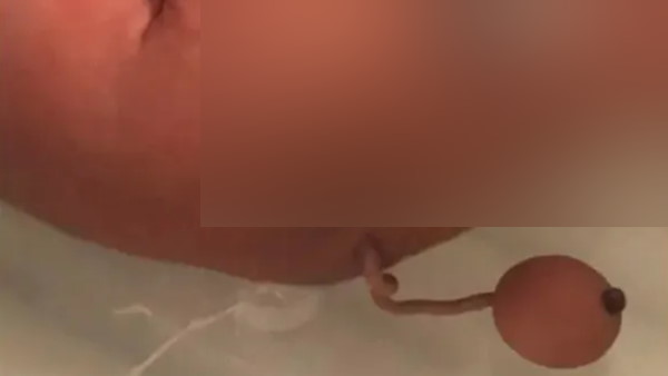 अल्ट्रासाउंड में नहीं दिखे थे पूंछ के सबूत