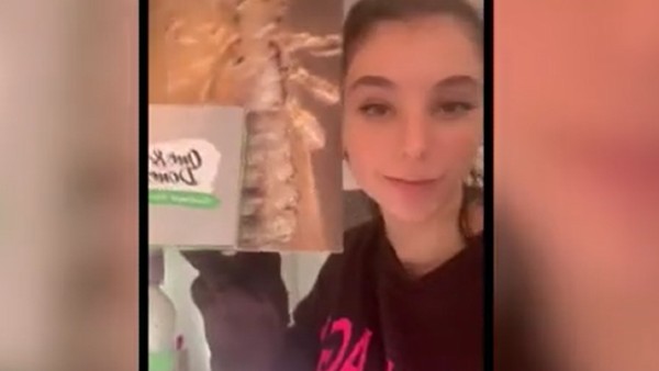 गर्दन पर पहुंची जूं