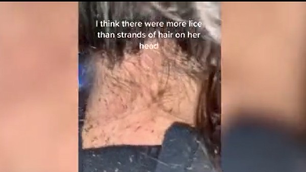 गंजी होने को तैयार नहीं