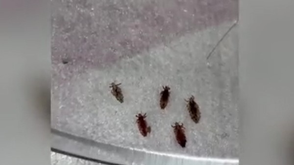 पूरी तरह से जुएं का कब्जा