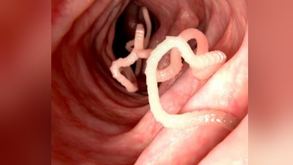 अजीबोगरीब दौरा देख डॉक्टर हैरान