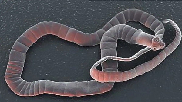 इस वजह से शरीर के अंदर पहुंच सकता है टेपवर्म