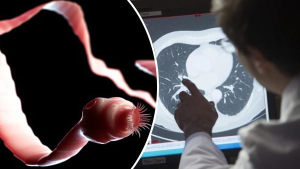 मरीज को देख डॉक्टर भी हैरान