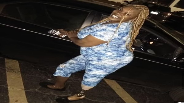 पेडीक्योर के बाद संक्रमण फैलने से काटना पड़ा था महिला का पैर