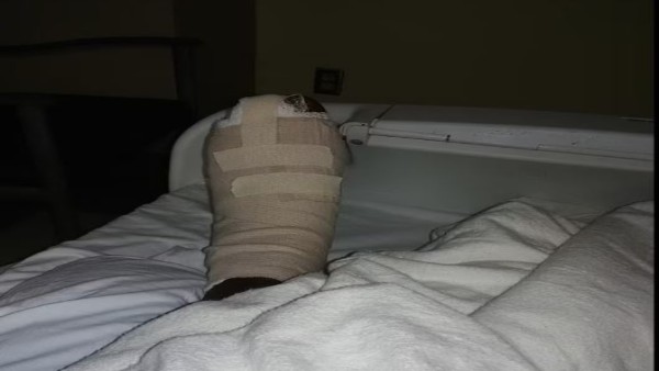 इलाज में बिक गया शेलमैन का घर फिर भी नहीं बचा पैर