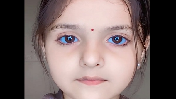 2. इस बच्ची ने अपनी आंखों से जीता सबक दिल
