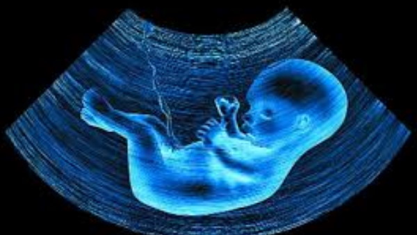 इस वजह से होता है ऐसा