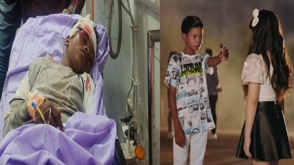 सिर में लगे 4 टांके, हालत नाजुक