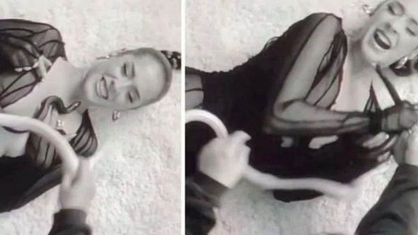 सिंगर को सांप ने चेहरे पर काटा