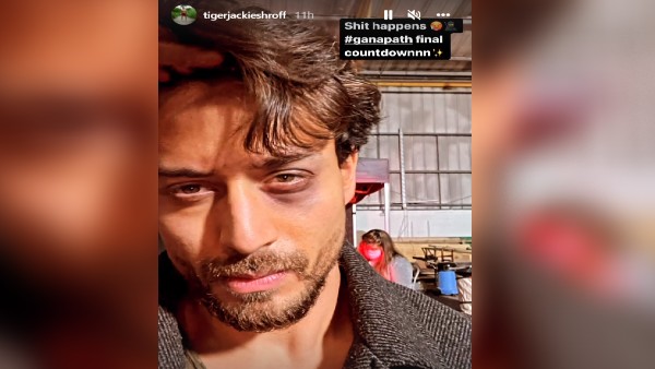 टाइगर की आंख में आई सूजन