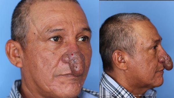 सर्जरी ही एकमात्र विकल्प सर्जरी ही एकमात्र विकल्प