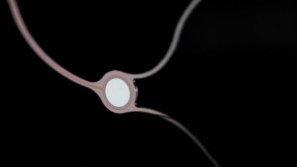 मोटर न्यूरॉन डिजीज का इलाज