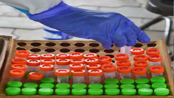 RT-PCR परीक्षण अनिवार्य कर दिया गया है RT-PCR परीक्षण अनिवार्य कर दिया गया है