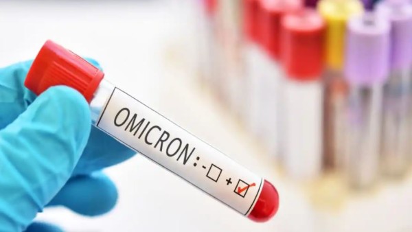 'PCR टेस्ट से भी तेज होगा, ये X-ray जांच' 