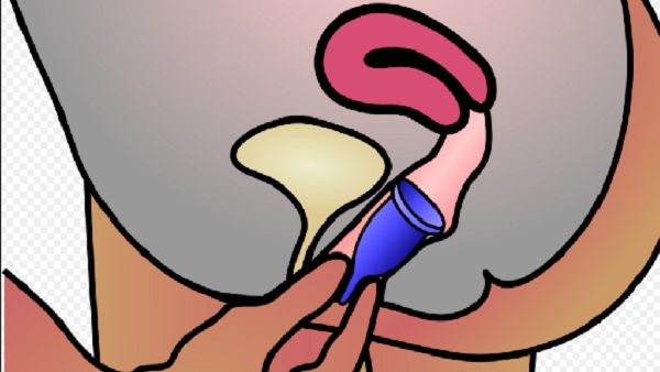 हर तरह से सुरक्षित है Menstrual Cups हर तरह से सुरक्षित है Menstrual Cups
