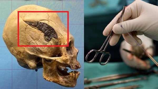 म्यूजियम में रखी है खोपड़ी