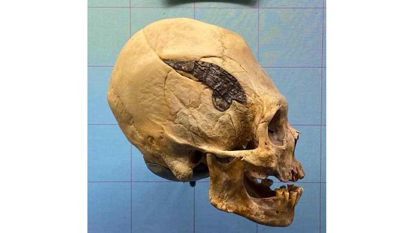 धातु की पहचान नहीं