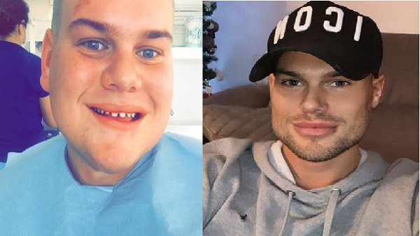 प्लास्टिक सर्जरी पर खर्च किए ढाई करोड़ से अधिक