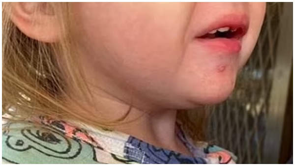 'प्लीज अपने बच्चों को किसी को चूमने ना दें...' 'प्लीज अपने बच्चों को किसी को चूमने ना दें...'