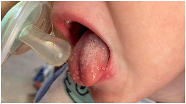 'मेरी बेटी के मुंह में खून था और वह दर्द में चिल्ला रही थी...' 'मेरी बेटी के मुंह में खून था और वह दर्द में चिल्ला रही थी...'