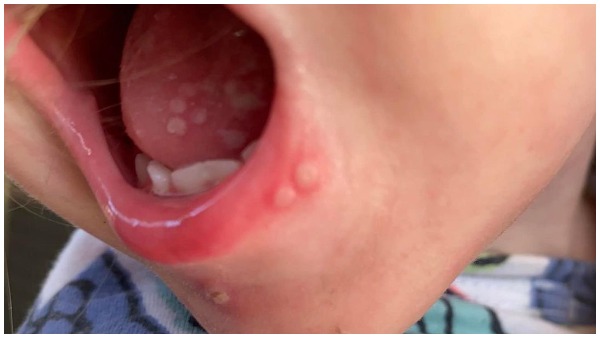 कैसे फैलता है ये वायरस कैसे फैलता है ये वायरस