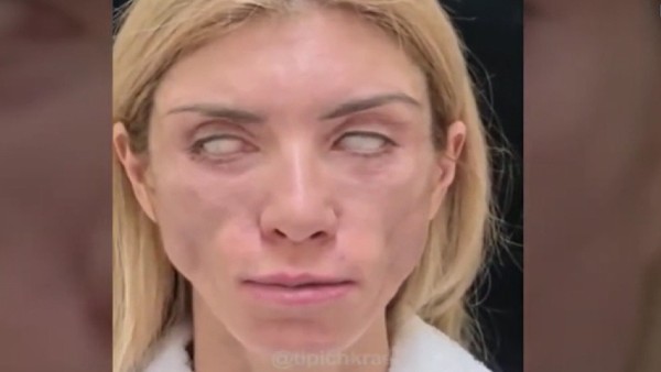 डॉक्टरों ने ली मोटी फीस