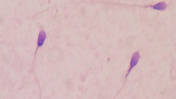 Air pollution शुक्राणुओं की संख्या और गति को प्रभावित कर रहा 