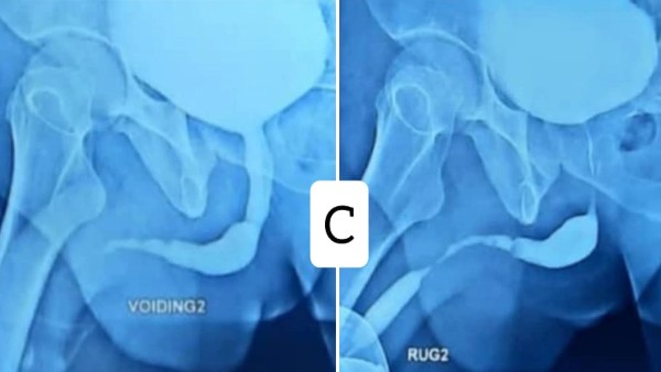 टीवी शो को देखकर की हरकत