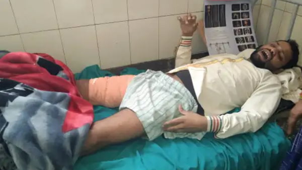 सड़क हादसे में हुआ था पैर में फ्रैक्चर