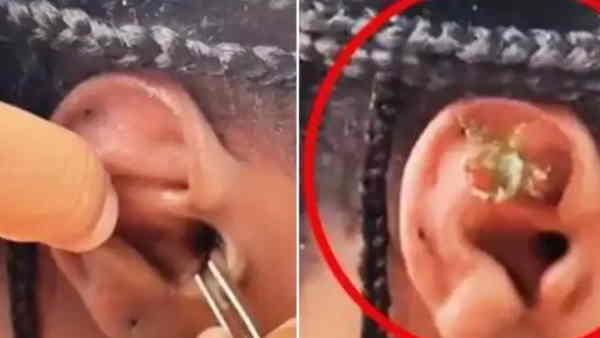 crab enter in woman ear while snorkeling video gone viral on social media crab enter in woman ear while snorkeling video gone viral on social media