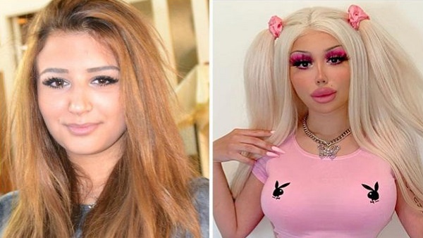 अब महिला ने बताया पहले कैसी दिखती थीं अब महिला ने बताया पहले कैसी दिखती थीं