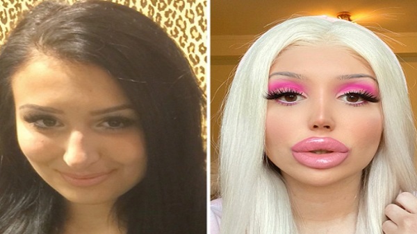 ब्रेस्ट से लेकर बट इम्प्लांट्स तक की है योजना ब्रेस्ट से लेकर बट इम्प्लांट्स तक की है योजना