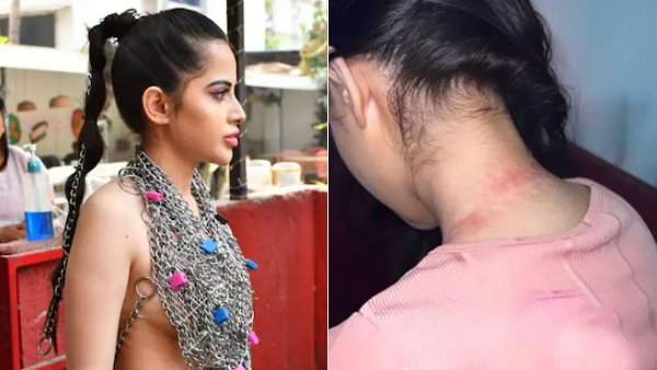 उर्फी ने दिखाई गले की हालत