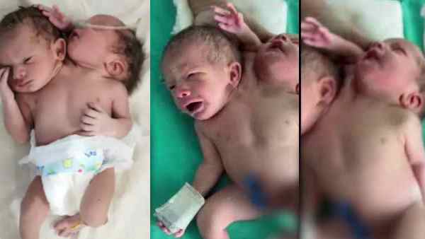 माता-पिता उसके लिए कर रहे है दुआ